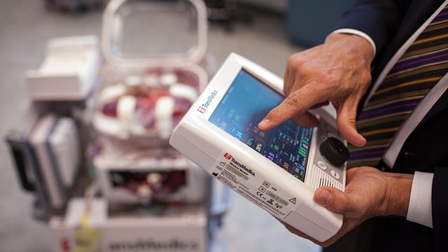 transmedics_heart_machine_533885888.jpg 