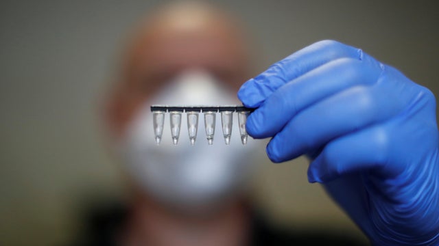 Saliva tests for the coronavirus disease (COVID-19) in Marseille 