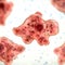 Case of brain-eating amoeba in Florida possibly linked to sinus rinse