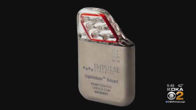 optimizer-smart-device.jpg 