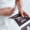 Bill would make fathers pay child support from conception