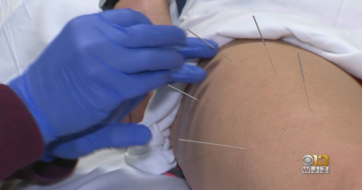 This New Technique Targets Trigger Points Within Muscle To Treat ...