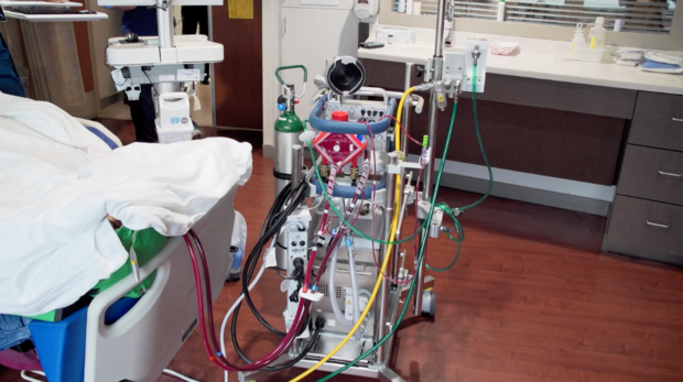 Extracorporeal membrane oxygenation machine 