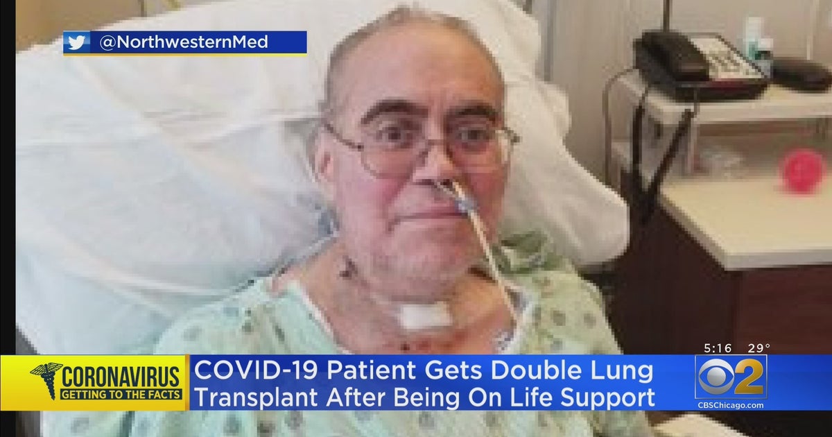 COVID19 Patient Gets Double Lung Transplant After Being On Life