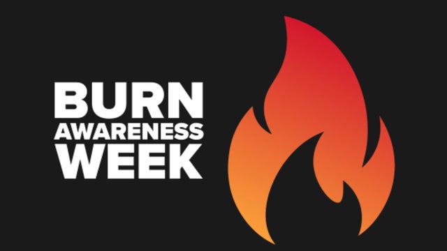 Burn-Awareness-Week.jpg 