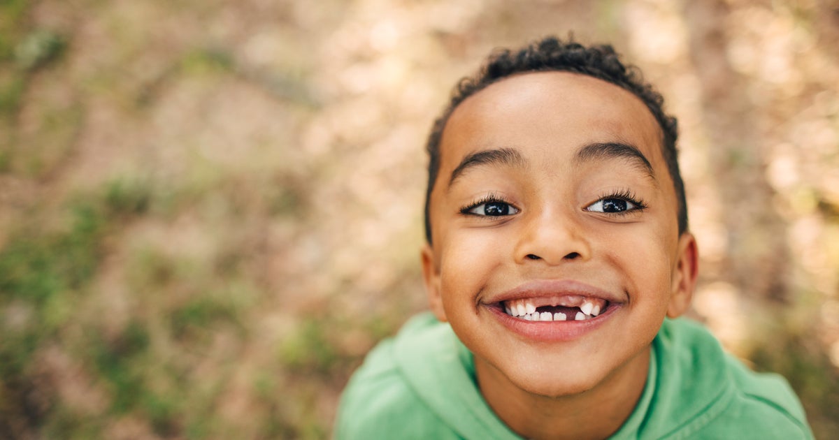 Tooth Fairy's Payout Reaches New Heights CBS Minnesota