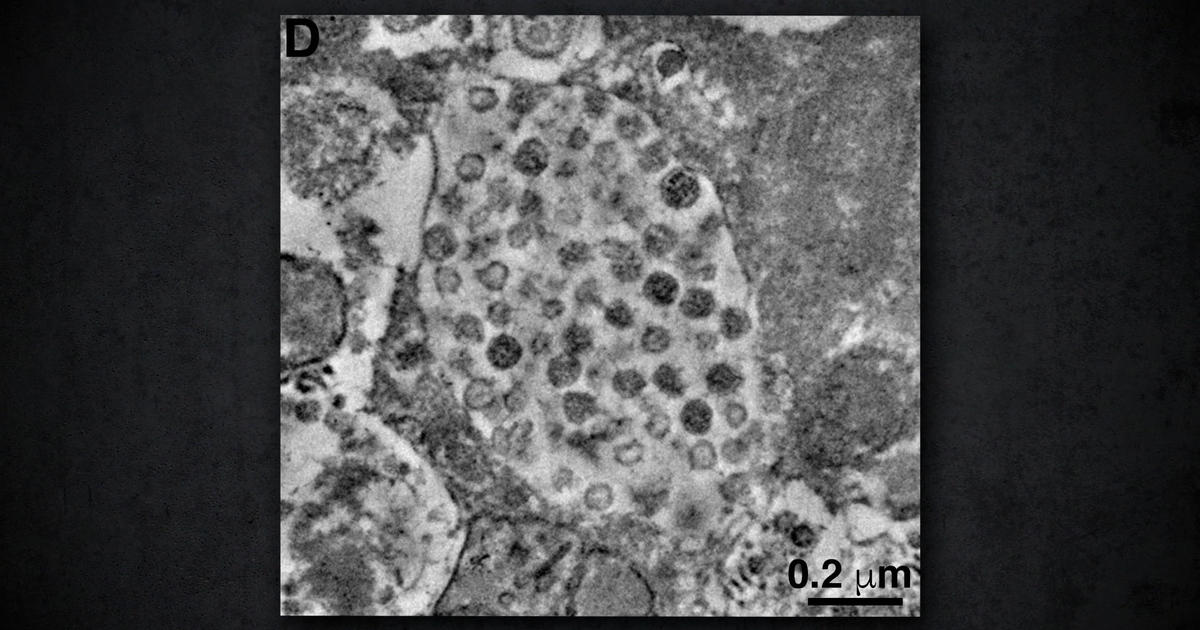 The coronavirus variants experts are most concerned about