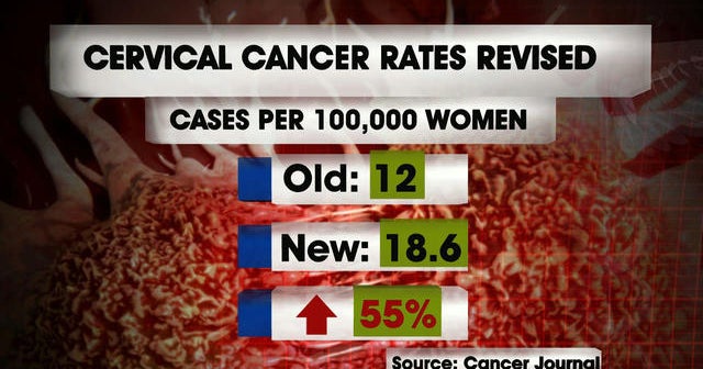 Cervical cancer rates show dramatic increase in U.S. - CBS News