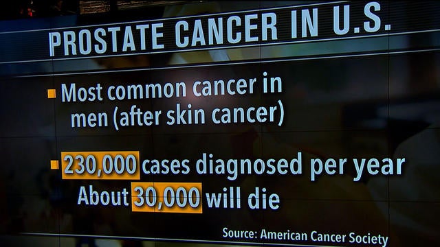 ctm-060214-prostate-640x360.jpg 
