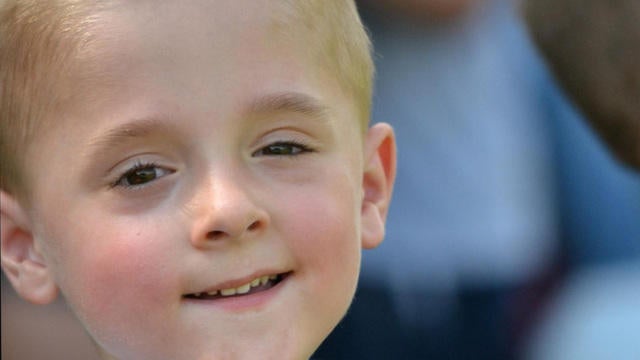 satmo-101114-enterovirus-290413-640x360.jpg 