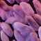 Drug-resistant superbugs' spread surging, World Health Organization warns