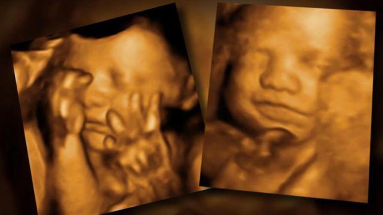 Repaste tvetydigheden gået vanvittigt 3-D ultrasounds cause concern for OBGYN doctors and FDA - CBS News