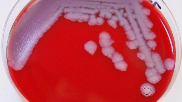 en-0603-anthrax-401850-640x360.jpg 