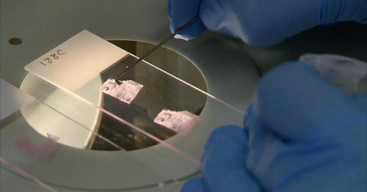 blood-test-could-help-detect-breast-cancer-cbs-news