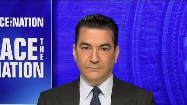 cbsn-fusion-gottlieb-says-biden-administration-should-have-surged-vaccines-to-michigan-weeks-ago-thumbnail-689905-640x360.jpg 