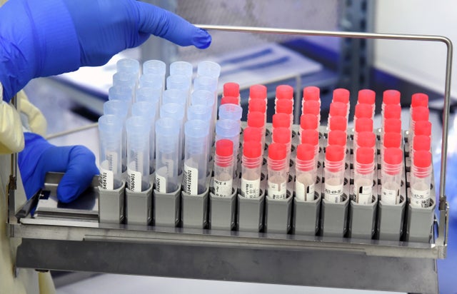 Diagnostics of SARS-CoV-2 and virus variants 