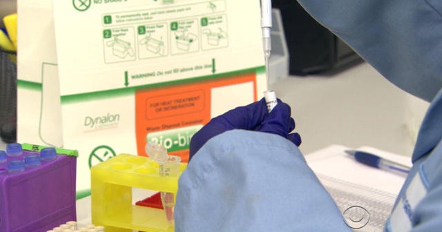 Does Blood Test Really Work For Early Cancer Detection Cbs News Does Blood Test Really Work For Early Cancer Detection Cbs News