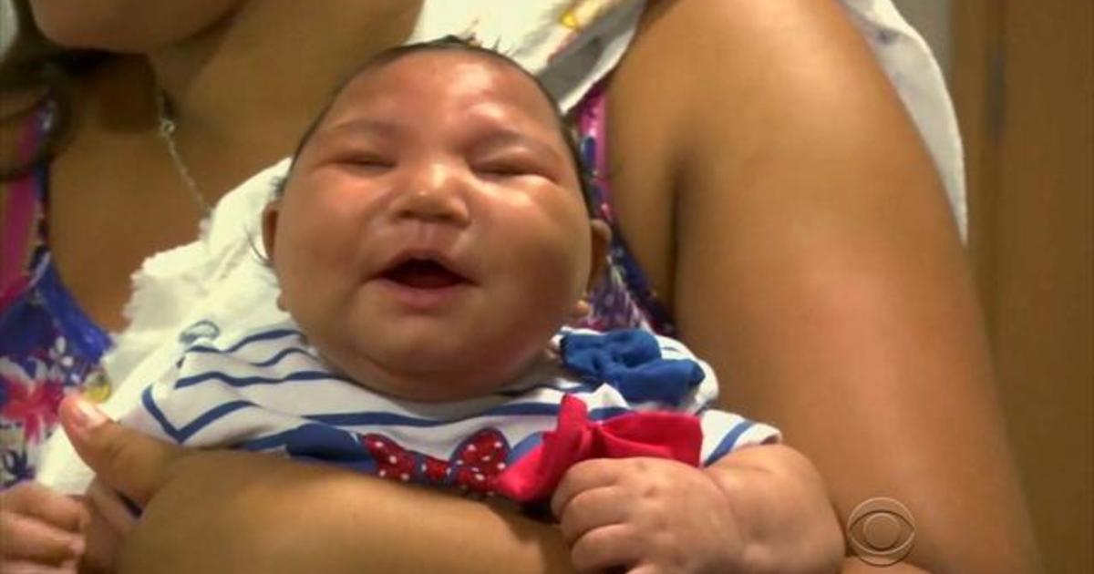14 More Cases Indicating Zika Spread Through Sexual Contact Cbs News 