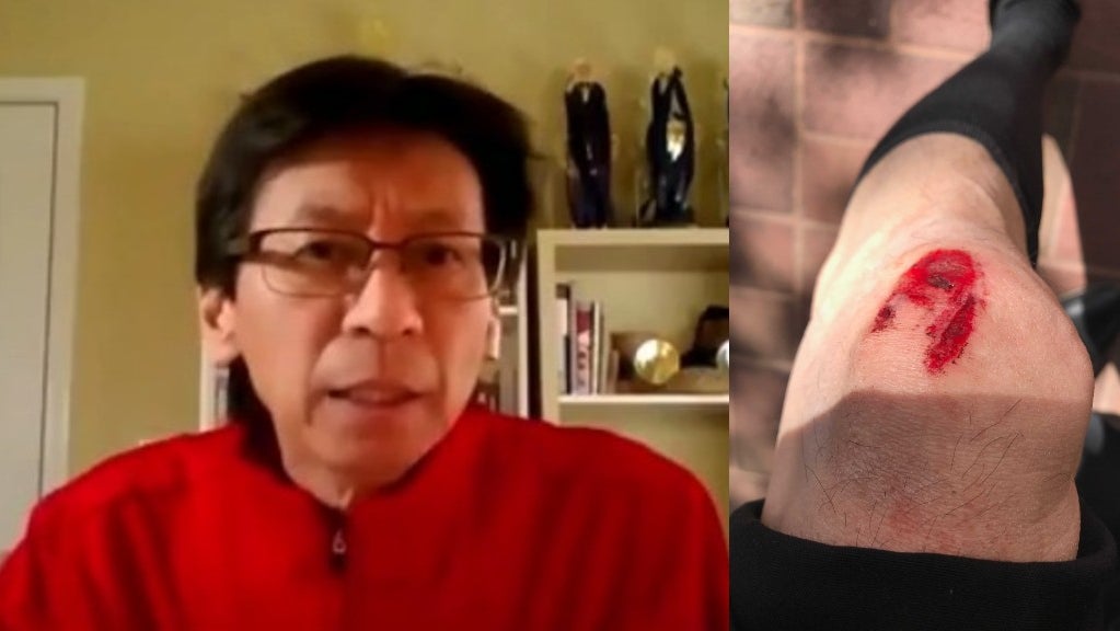 Carl Chan assaulted 