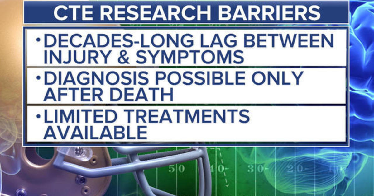 Study Of Junior Seau's Brain Finds Signs Of Neurodegenerative