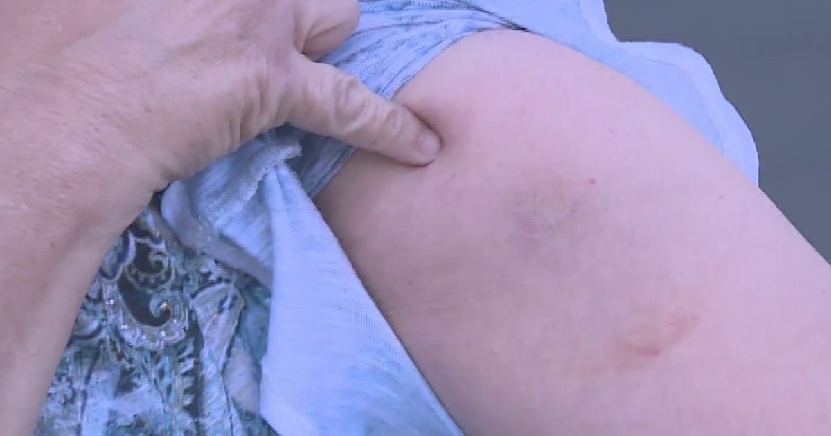 'I Was Mad' More Victims Report DriveBy Paintball Attacks In