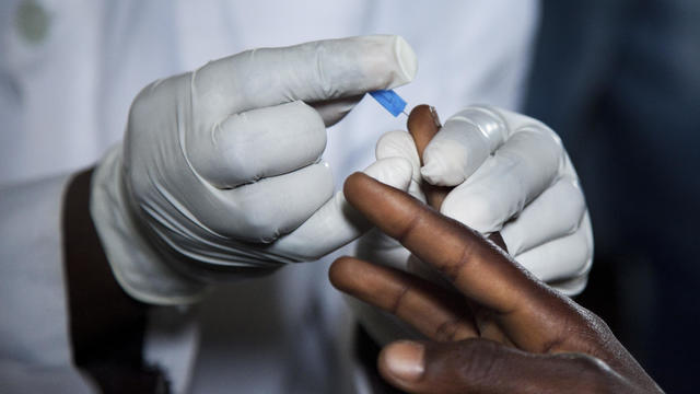 Nigeria - Makurdi - A health worker prick a finger tip to draw blood 