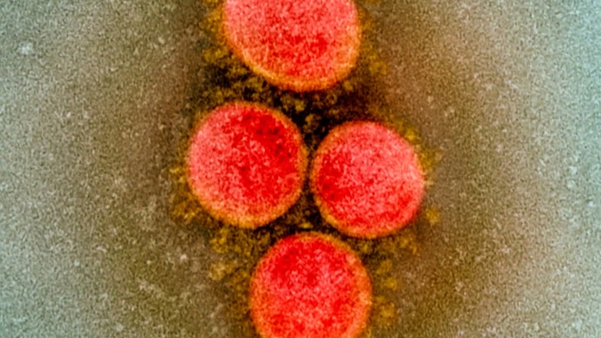 COVID In Colorado: Over 600 Cases Of Delta Variant Confirmed In Mesa ...
