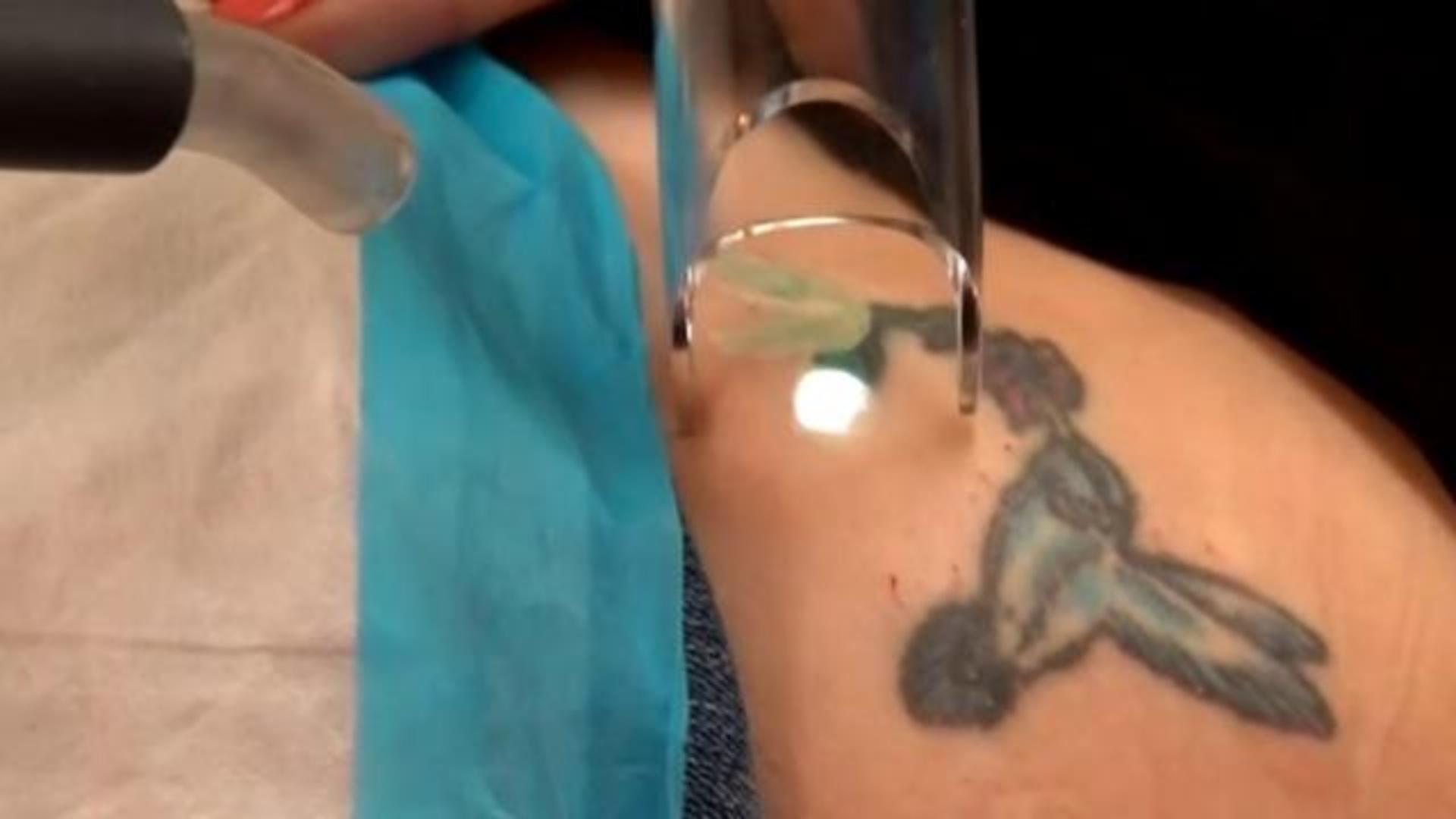 Exgang member escapes troubled past through tattoo removal  abc10com