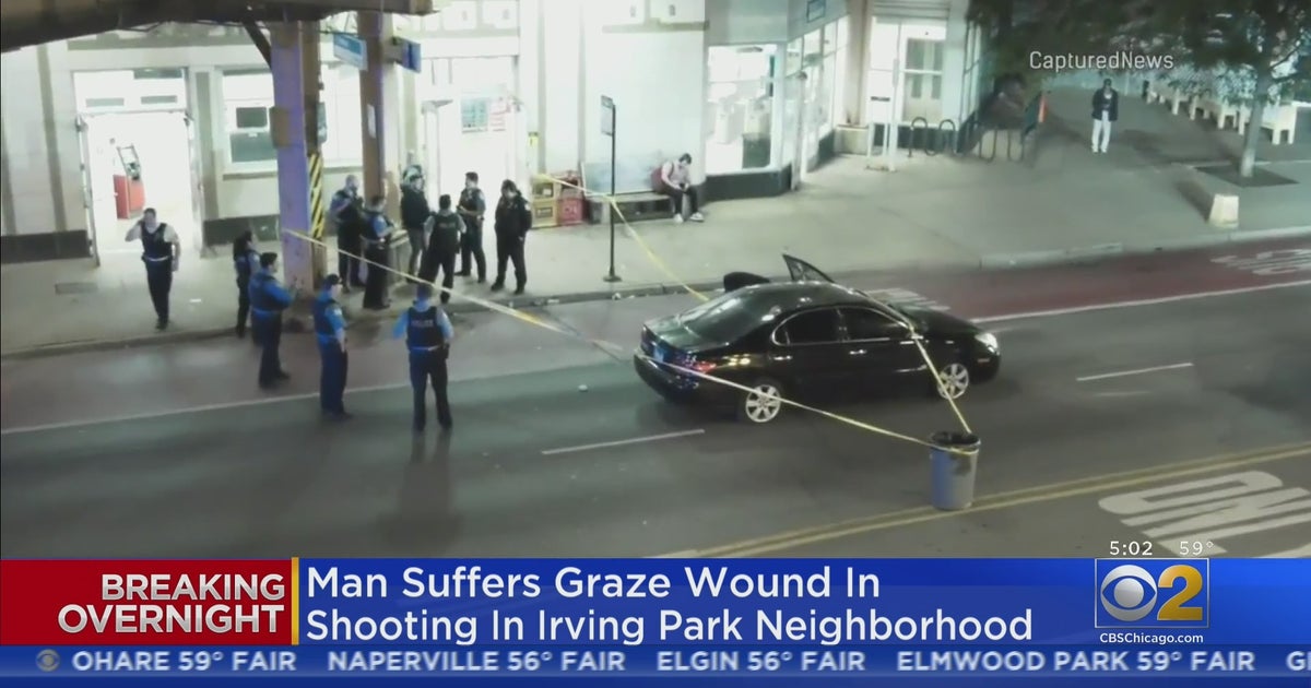 Man Suffers Graze Wound During Shooting In Irving Park CBS Chicago