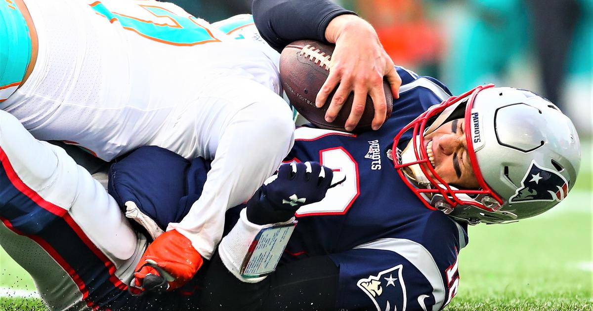 Tom Brady's History Of Playing Through Injury Is Kind Of Incredible - CBS  Boston