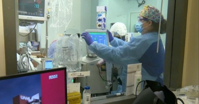 Delta variant fuels rise in COVID cases across 48 states - CBS News