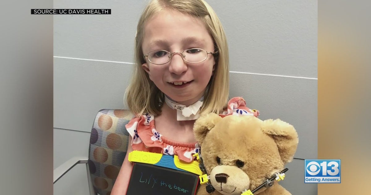 'It's Very Challenging' Rare Condition Forces Girl To Barely Open