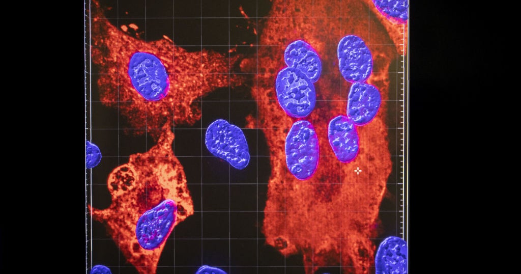 COVID19 In Maryland More Than 1.2K New Cases & 14 Deaths Reported