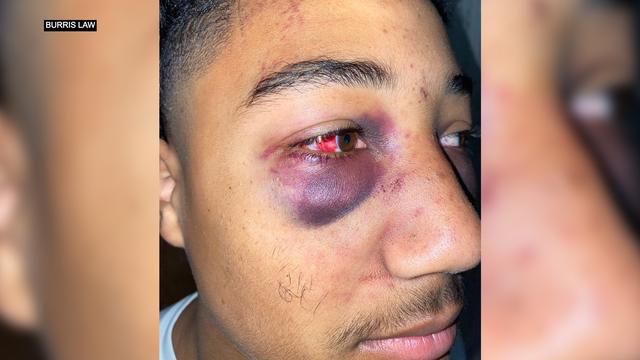 STOCKTON-TEEN-BEATEN-BURRIS-LAW.jpg 