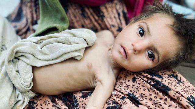 afghanistan-starving-child.jpg 