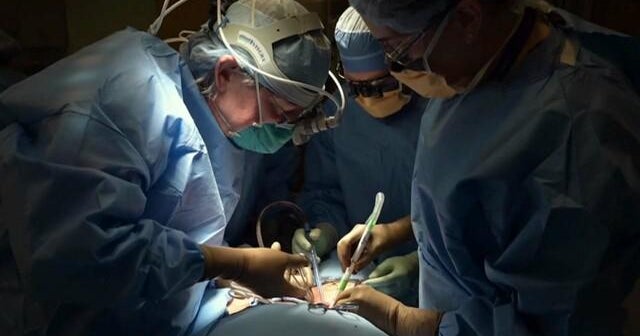 Doctors complete first successful pigtohuman kidney transplant CBS News