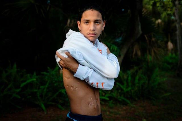 Parkland Survivor Anthony Borges Settles Lawsuit With Broward School  District - CBS Miami