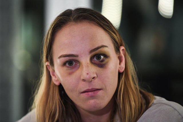 FRANCE-JUSTICE-ASSAULT-JUDO 