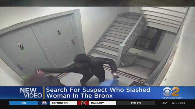 bronx-slashing-suspect-1.jpg 