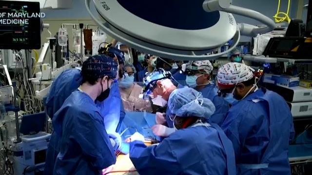 cbsn-fusion-doctors-transplant-pig-heart-into-human-for-first-time-thumbnail-870848-640x360.jpg 