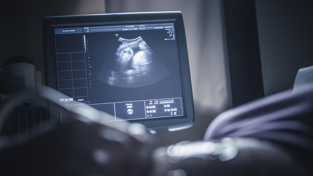 Prenatal-ultrasound.jpg 