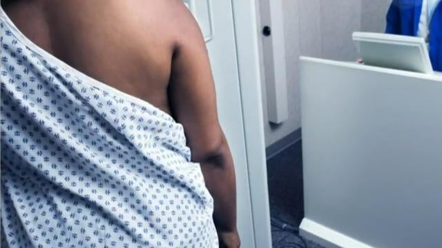 cbsn-fusion-breast-cancer-study-finds-standard-treatments-less-effective-for-black-women-thumbnail-903293-640x360.jpg 