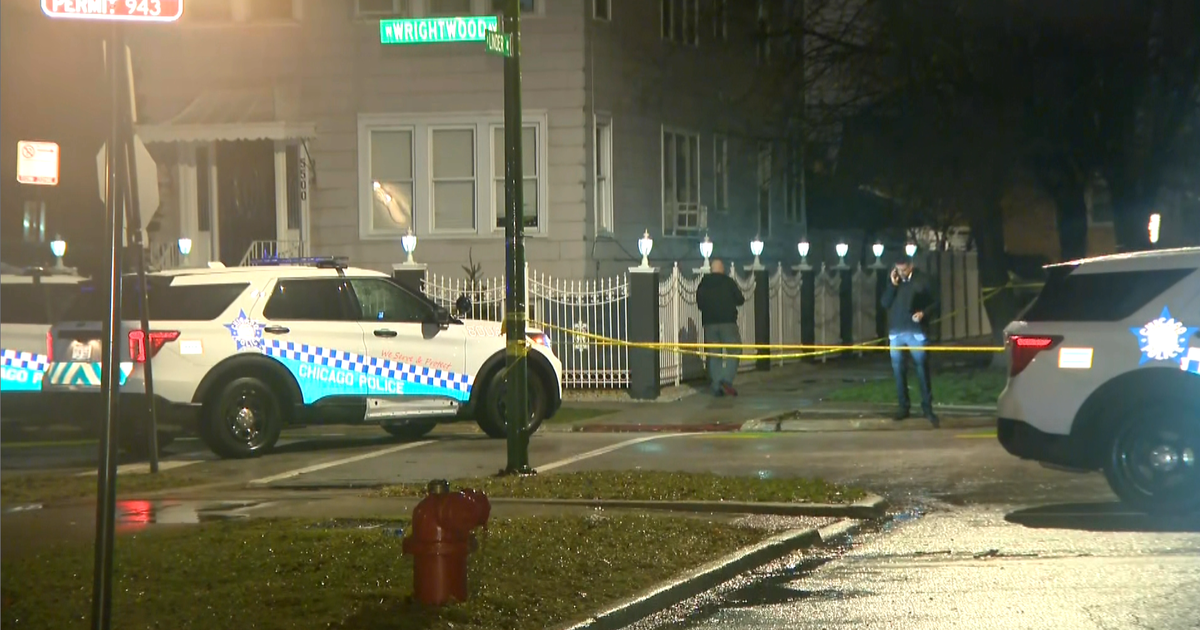 1-year-old Girl Grazed In Head In Belmont Cragin Shooting - CBS Chicago