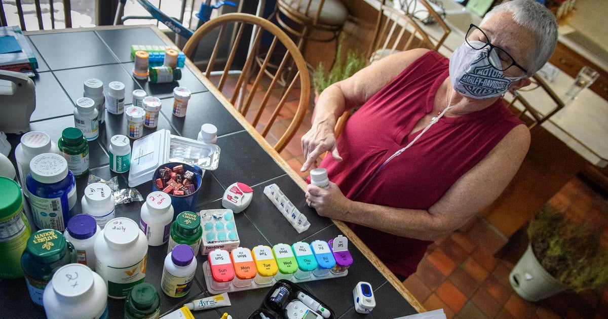 New national research effort focuses on mysteries of long COVID - CBS News