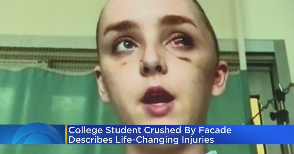College student crushed by façade describes life-changing injuries ...