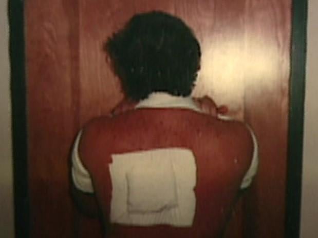 shelton-taylor-injury.jpg 