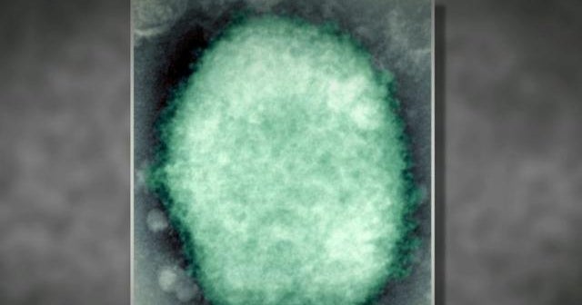 What is monkeypox and what are the symptoms of the rare disease? - CBS News