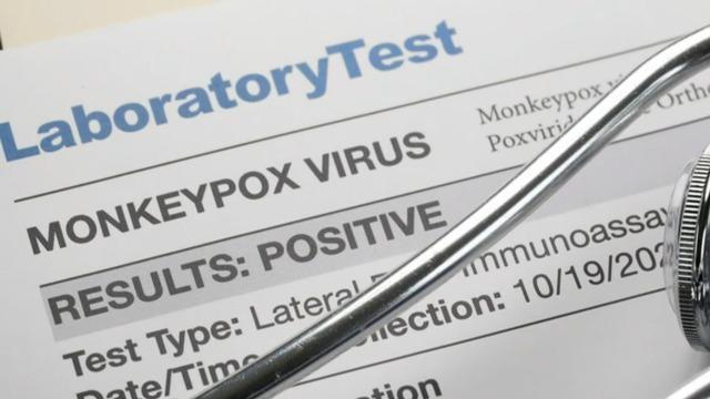 monkeypox-virus.jpg 