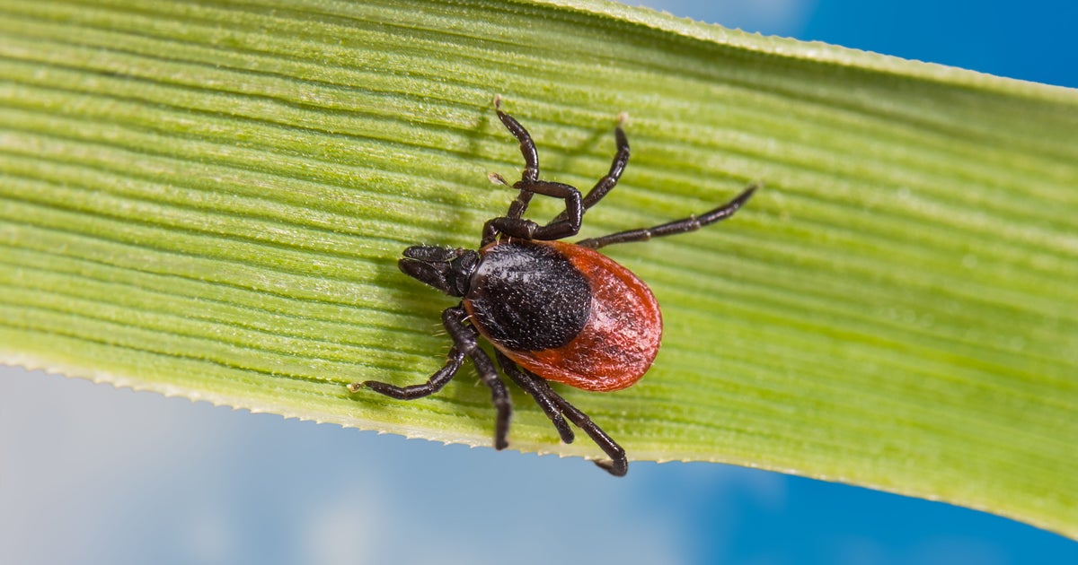 Public health officials warn of tickborne disease Babesiosis CBS