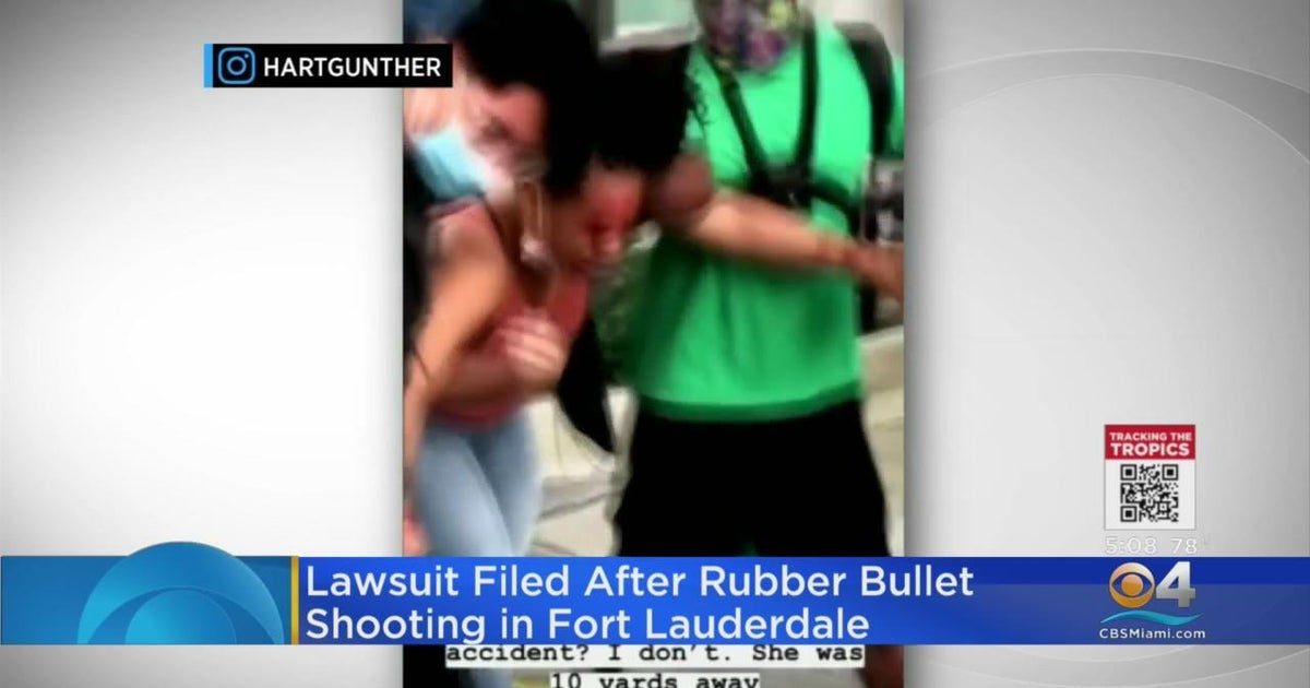 LaToya Ratlieff, who was shot with a rubber bullet during a BLM protest, suing Fort Lauderdale